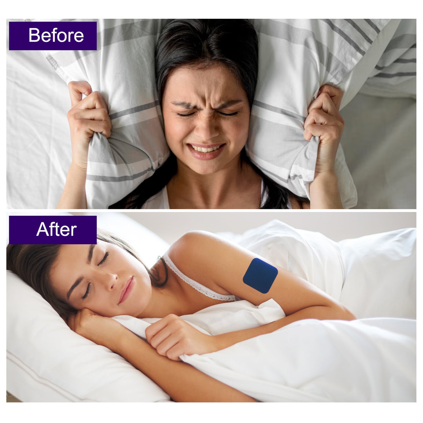 Sleep Patches
